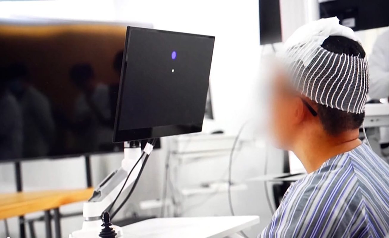 [ad_1] Un bărbat de 28 de ani, paralizat de opt ani din cauza unei leziuni severe a măduvei spinării, a reușit să controleze diverse dispozitive doar cu gândul, la cinci zile de la o intervenție chirurgicală în China