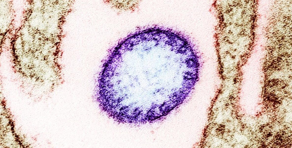 virus-Nipah.jpg - PresaObiectiva