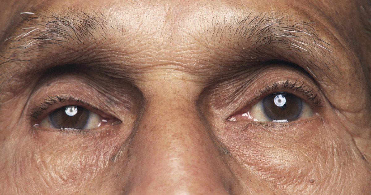 O bacterie oculară ar putea accelera boala Alzheimer, relevă un nou studiu Prezența bacteriei Chlamydia pneumoniae în retină este asociată cu declinul cognitiv și cu boala Alzheimer, potrivit unui studiu efectuat de cercetătorii de la Cedars-Sinai Medical Center din Statele Unite