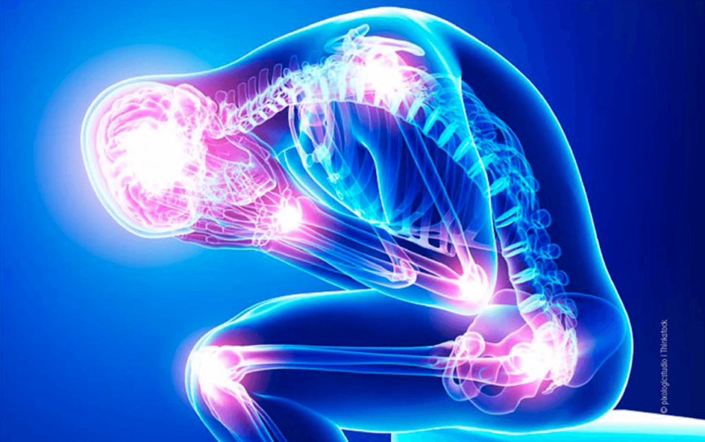 Inflamația articulară: semnul avertizor pentru un tratament precoce și evitarea complicațiilor Durerea și umflăturile la nivelul articulațiilor pot părea, pentru mulți, simple semne ale îmbătrânirii sau ale oboselii cotidiene