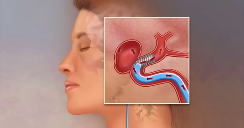 Neurolog: Două semne de avertizare care nu trebuie ignorate