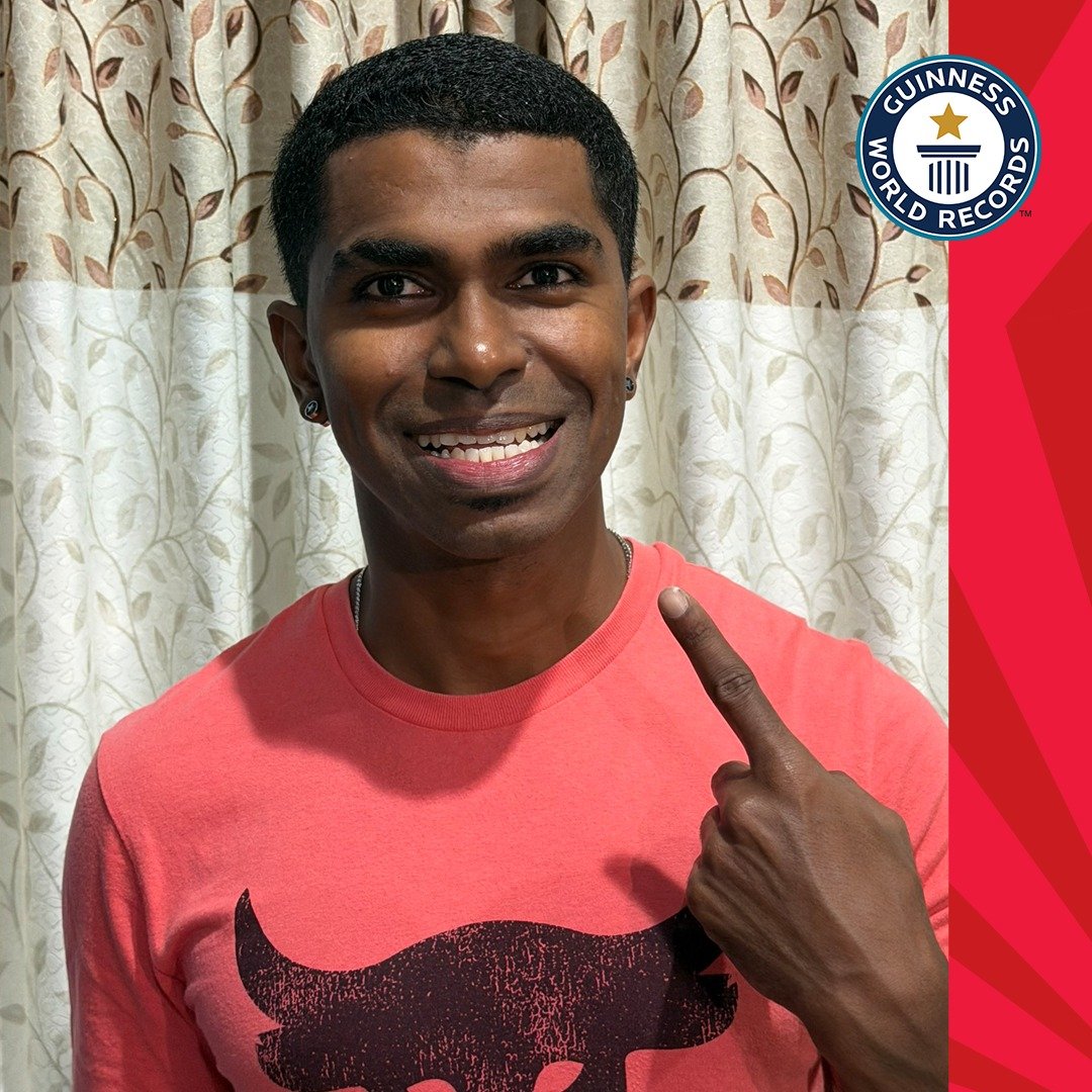 Un bărbat din Malaezia, recunoscut de Guinness World Records pentru raritatea sa, a stabilit un nou record mondial pentru cea mai mare numără de dinți într-o gură umană