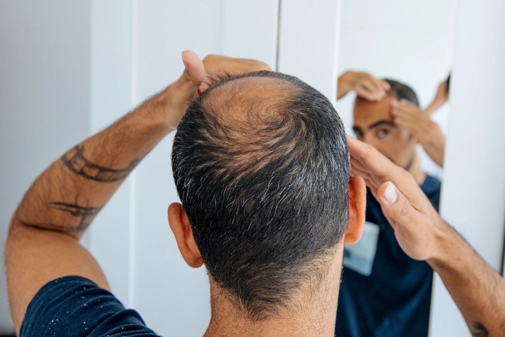 O descoperire de impact în domeniul medicinei regenerative ar putea schimba radical modul în care abordăm tratamentul pentru chelie