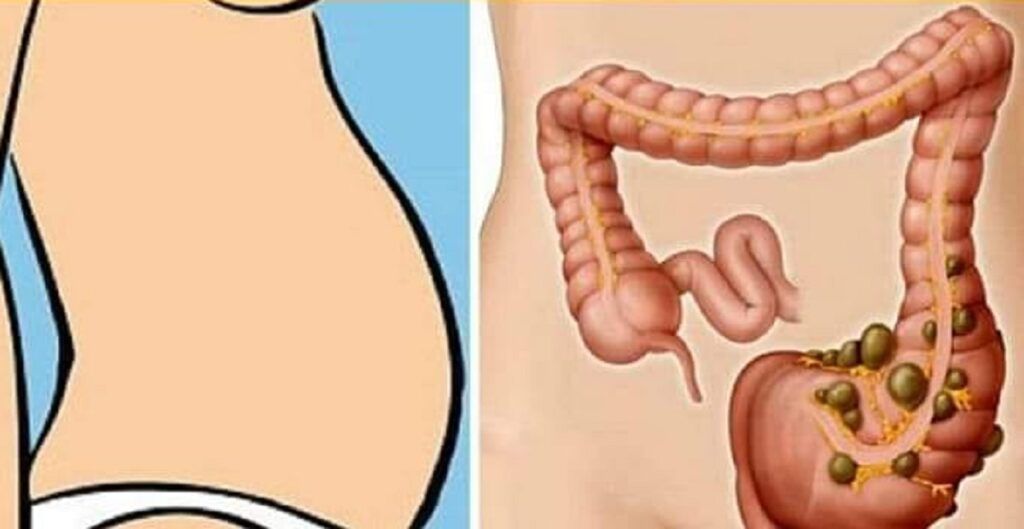 4 deficiențe de vitamine care pot cauza ascuns constipația