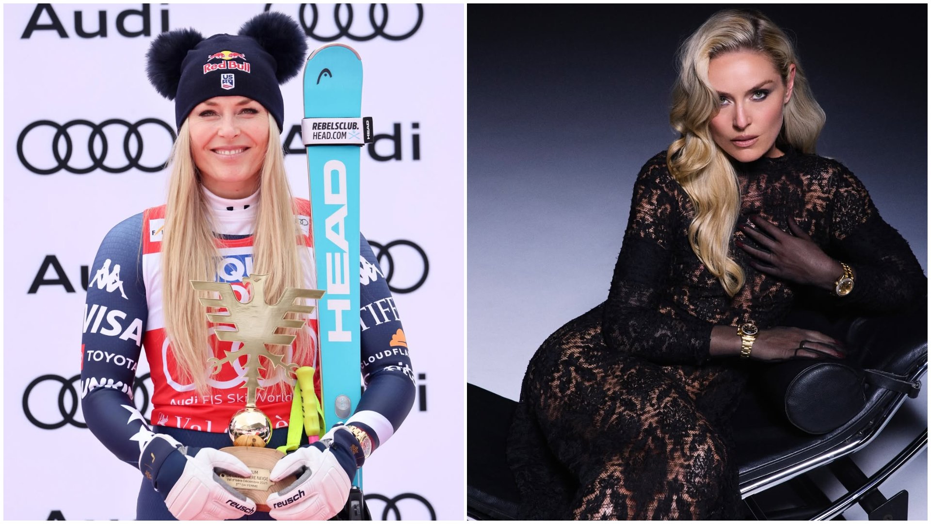 Lindsey Vonn a ieșit din spital și își re face pașii spre recuperare după accidentarea gravă suferită la Jocurile Olimpice de iarnă din 2026