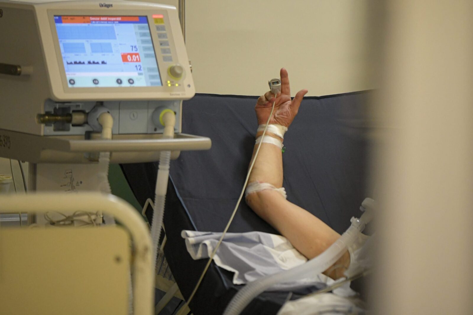 Mutație rară: Pacient HIV vindecat complet după transplant, o premieră