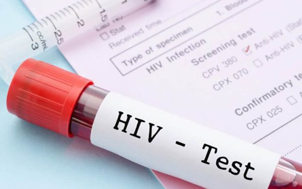 Bărbat vindecat de HIV, fără tratament. O premieră medicală uluitoare