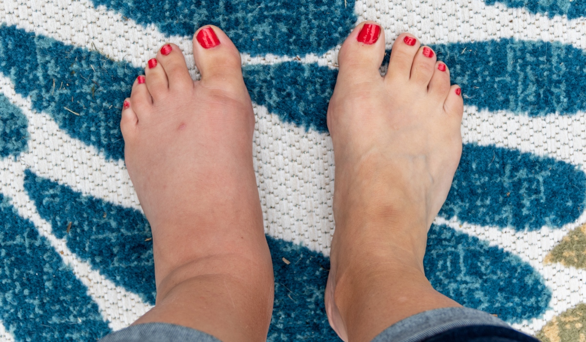 Semnele ascunse de pe picioare care îți pot salva viața