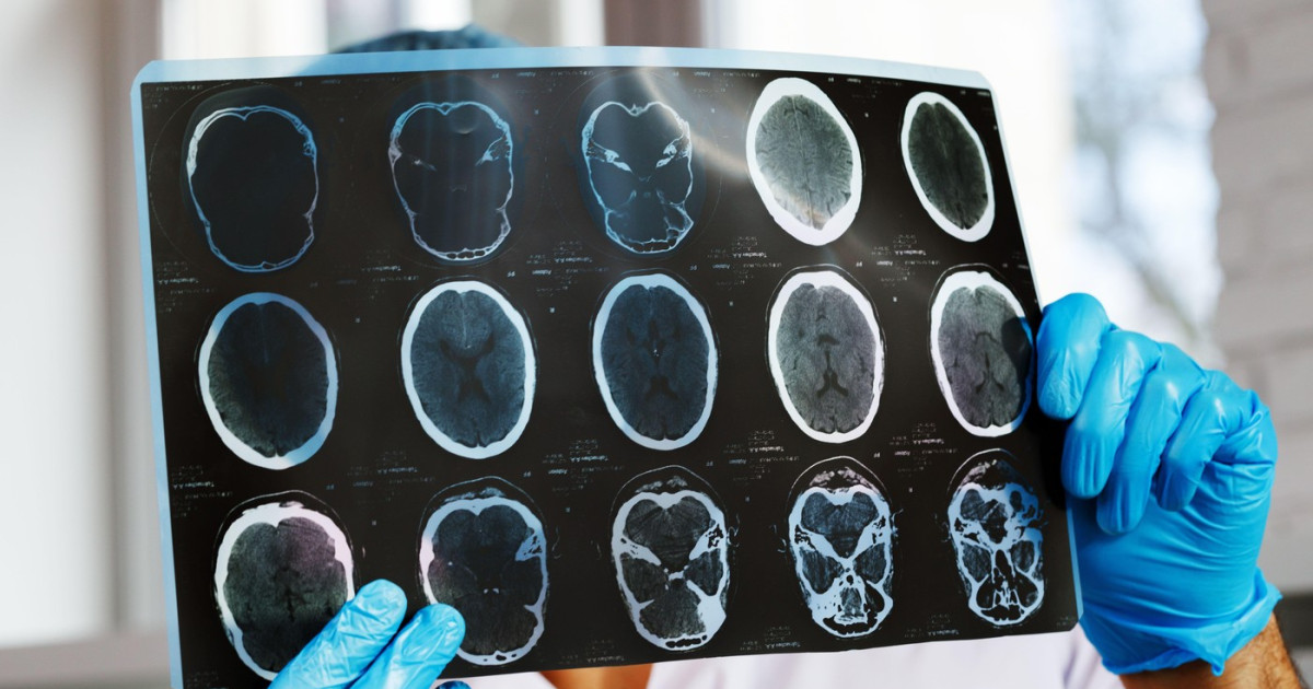 Asociațiile de pacienți solicită Ministerul Sănătății și CNAS intervenții după scăderea cu 47% a investigațiilor de monitorizare