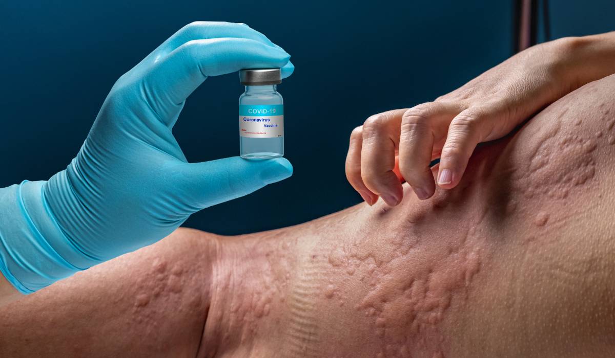 O tânără din România, diagnosticată cu peste 40 de alergii, a reușit recent să își redobândească o parte din libertate după un tratament pentru astm, fiind prima dată când a putut să mănânce din nou un măr după o deceniu de evitări și restricții severe