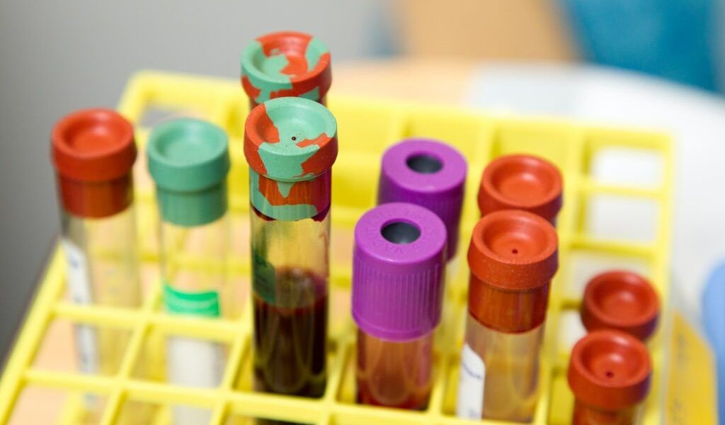 Cât costă analizele în 2026 pentru românii fără asigurare Diferența e URIAȘĂ