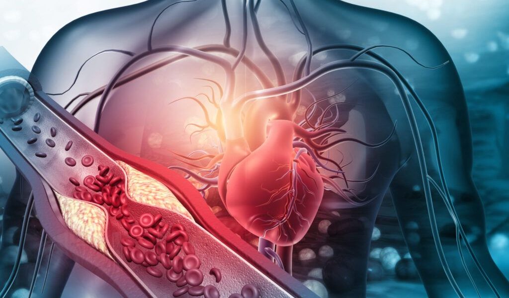 Prevenția cardiovasculară: Un ghid esențial pentru sănătatea inimii Infarctul și accidentul vascular cerebral (AVC) sunt cauze majore de deces la nivel mondial, dar riscul acestora poate fi semnificativ redus prin măsuri preventive