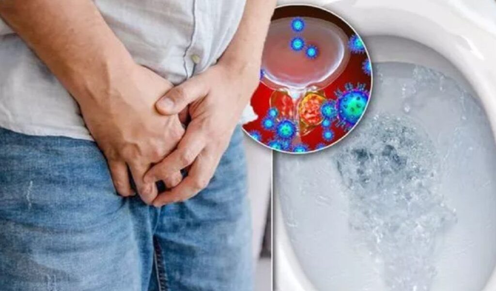 Cancerul „tăcut” care ucide bărbații: 3 semne ignorate. Atenție maximă