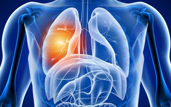 Alarmă după COVID-19: Ce se întâmplă cu plămânii pacienților