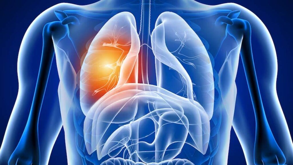 Alarmă după COVID-19: Ce se întâmplă cu plămânii pacienților