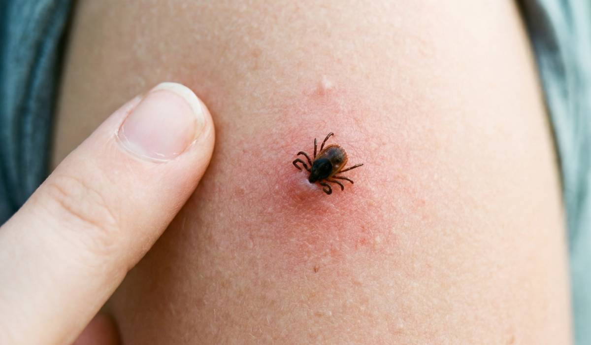 Iernile mai blânde și verile toride, cu precipitații din belșug, favorizează explozia populațiilor de insecte, inclusiv a acelora care pot pune în pericol sănătatea umană