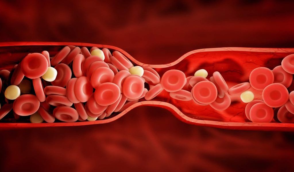 Semne de alarmă: Cheaguri de sânge pândește în mâini neașteptate