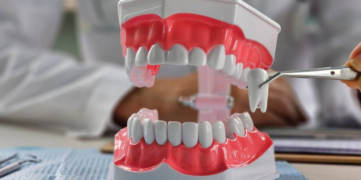 Extracții dentare vs. tratament fără: Ce aleg ortodonții și de ce?