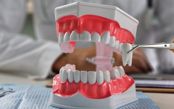 Extracții dentare vs. tratament fără: Ce aleg ortodonții și de ce?