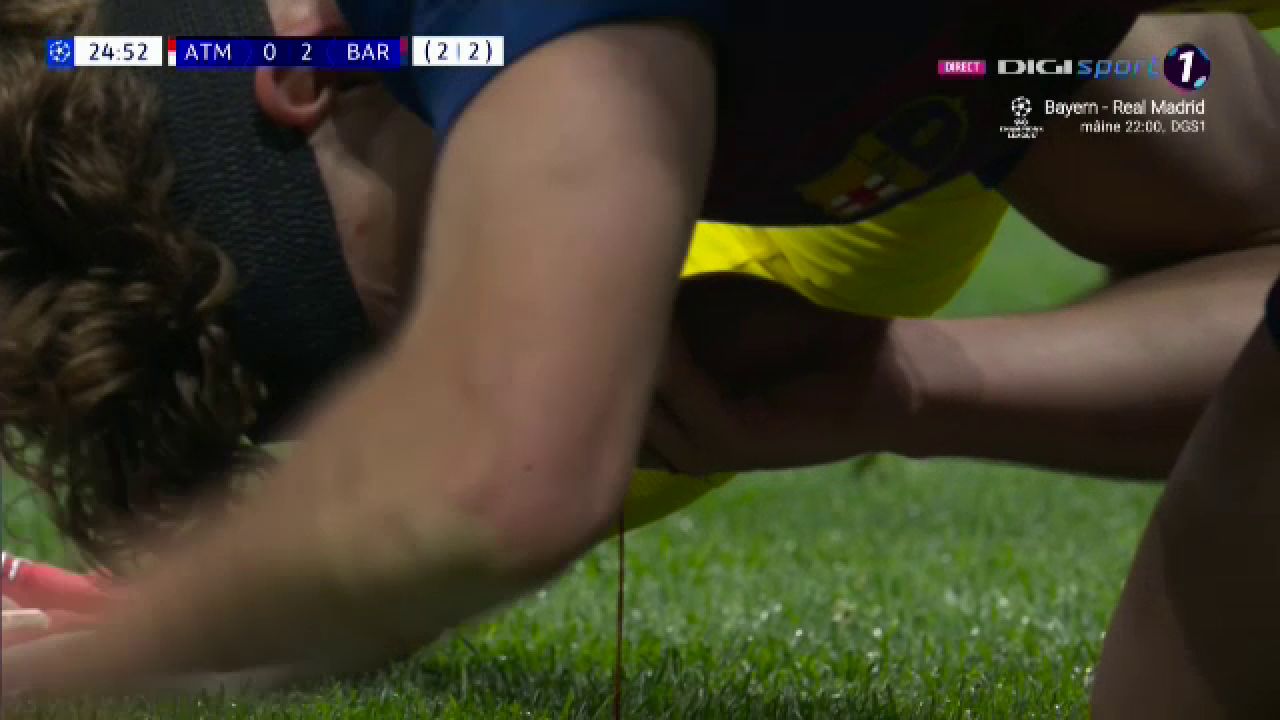 Sângerări șocante în Atletico – Barcelona: Fermin Lopez, accidentare cruntă