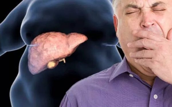 Boala ficatului gras: Tratament revoluționar fără dietă restrictivă