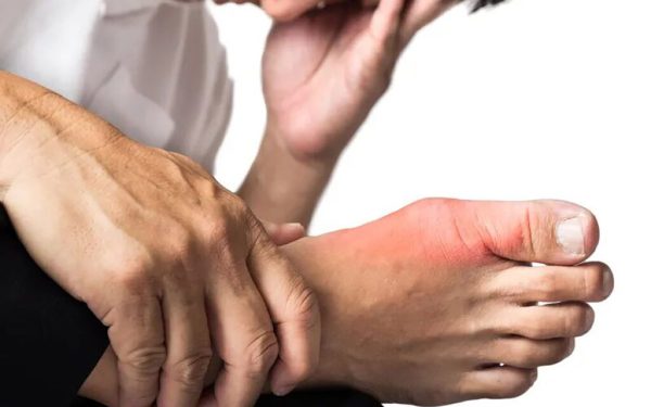 Vitamina-minune: Scapă de gută, reduce acidul uric și calmează durerea