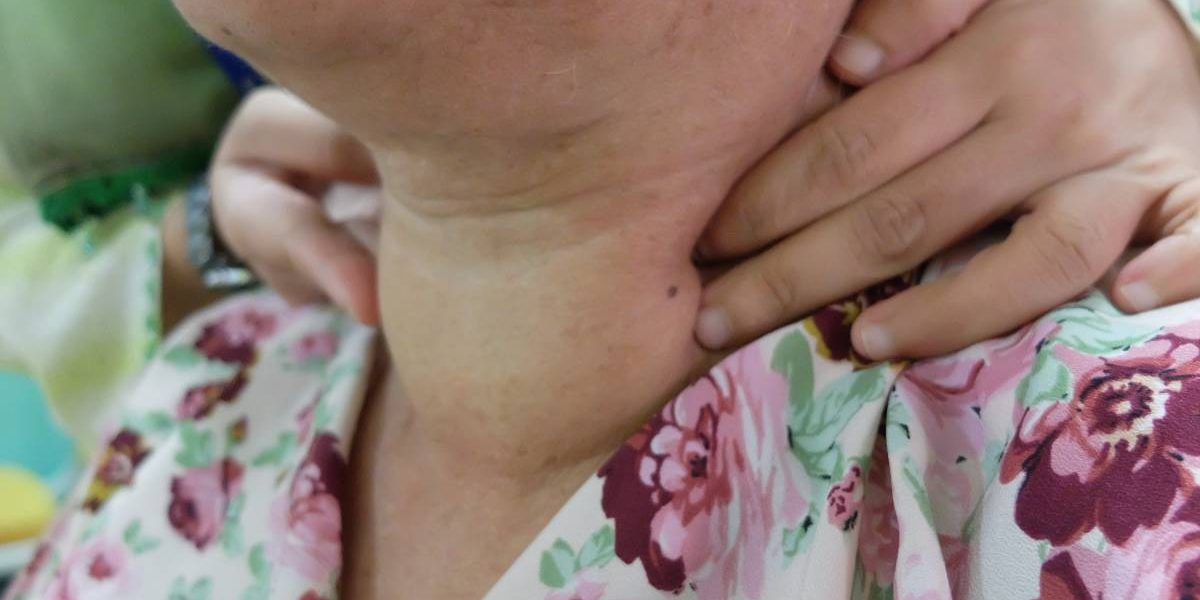 Boala care te umflă, oricât ai țținut dietă