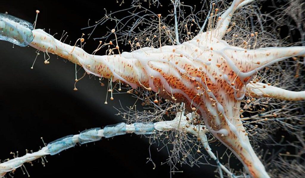 NOI DESCOPERIRI: Intestinul, noua țintă în lupta cu scleroza multiplă Oamenii de știință au identificat o legătură surprinzătoare între inflamația intestinală și scleroza multiplă (SM), o boală autoimună care afectează sistemul nervos central