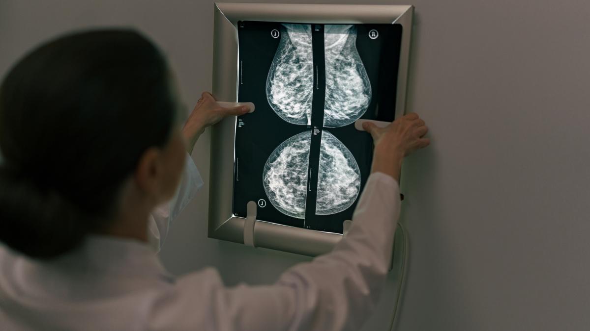 Depistarea precoce a cancerului de sân rămâne un element fundamental în combaterea acestei boli, fiind capabilă să salveze vieți și să reducă semnificativ impactul tratamentelor asupra pacienților