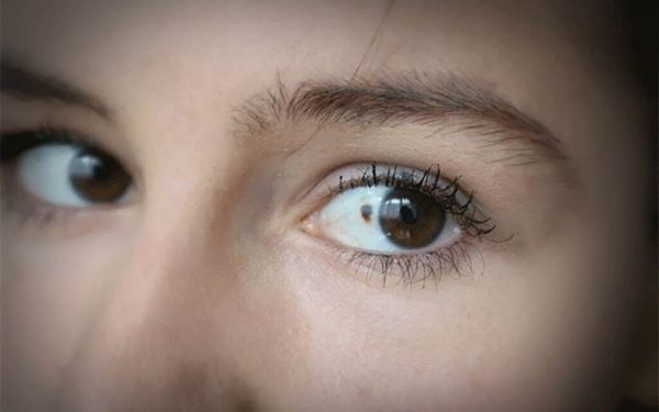 11 semne care trădează cancerul ocular. Vezi ce riscuri ascund ochii tăi