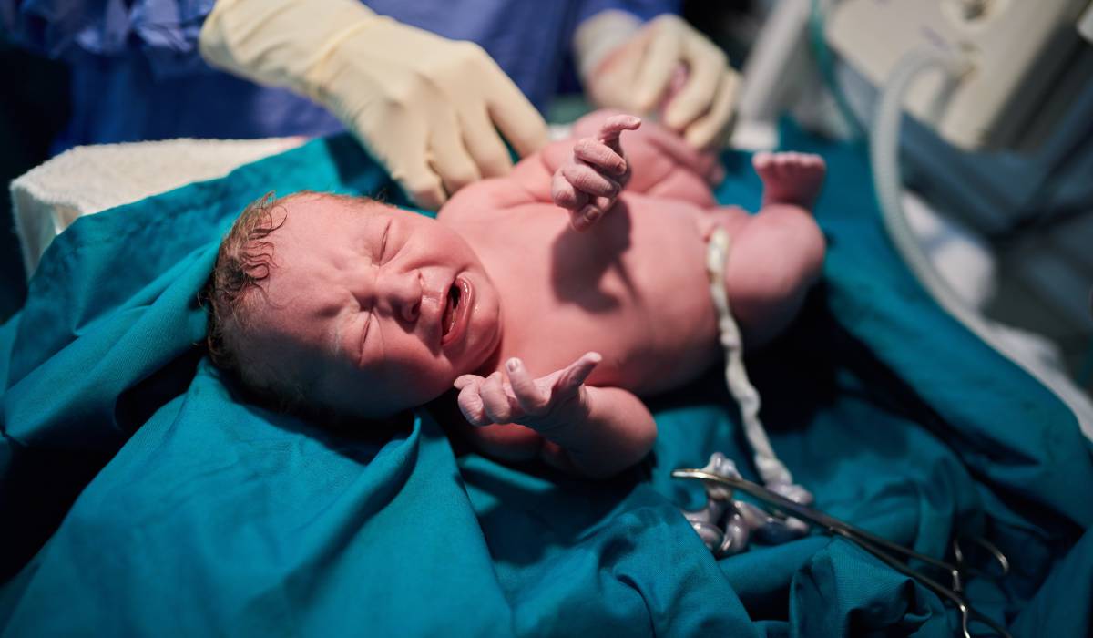 Pe parcursul perioadei de monitorizare, până în 2022, au fost înregistrate 2.252 de cazuri de accident vascular cerebral (AVC) în România, dovadă a răspândirii și gravității acestei boli