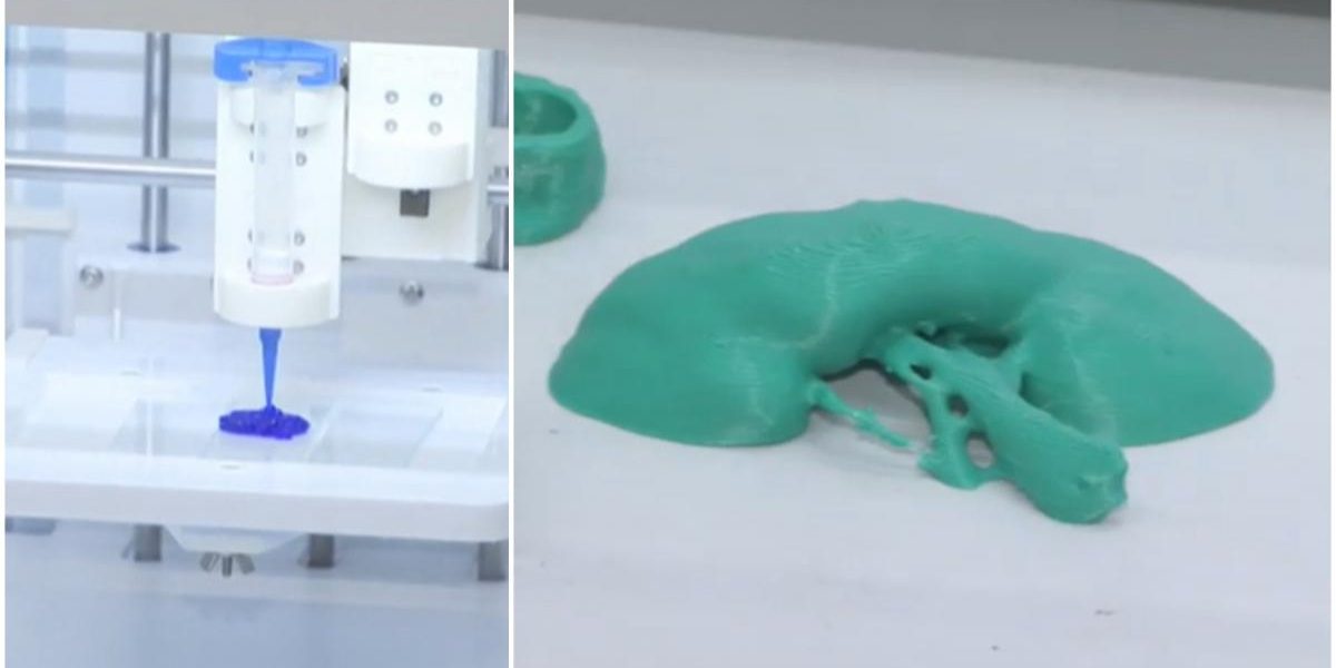 Rinichi „printat” în România: Cercetătorii uimesc cu medicina 3D!