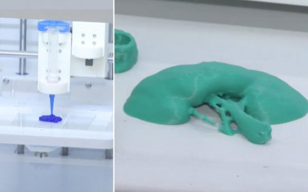 Rinichi „printat” în România: Cercetătorii uimesc cu medicina 3D!
