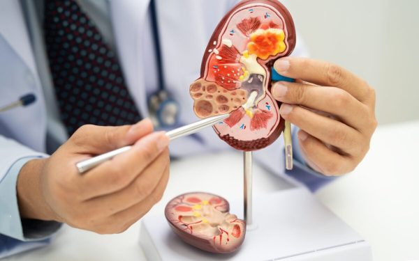 Acid uric și creatinină: Ce dezvăluie analizele despre rinichi