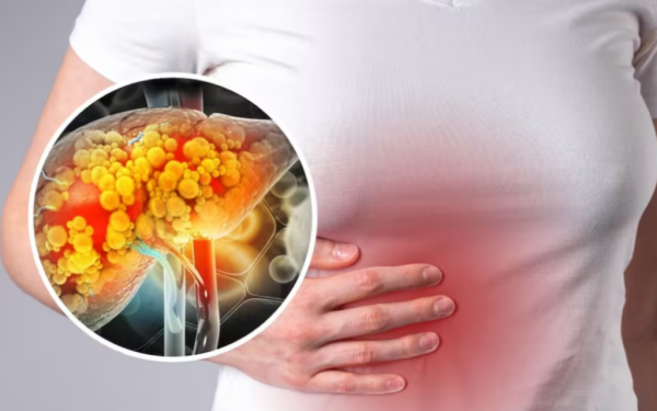 Moartea lui Thierry Ardisson: Cancerul de ficat, explozie până în 2050? Ce semnale nu trebuie ignorate