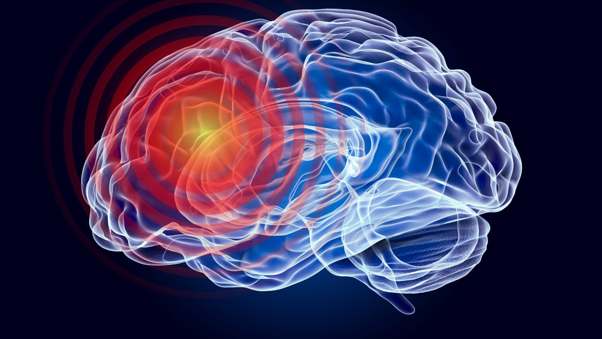 O nouă tulburare neurologică, cu origine genetică, a fost identificată de oamenii de știință, deschizând noi perspective de diagnostic pentru mii de copii și familii din întreaga lume
