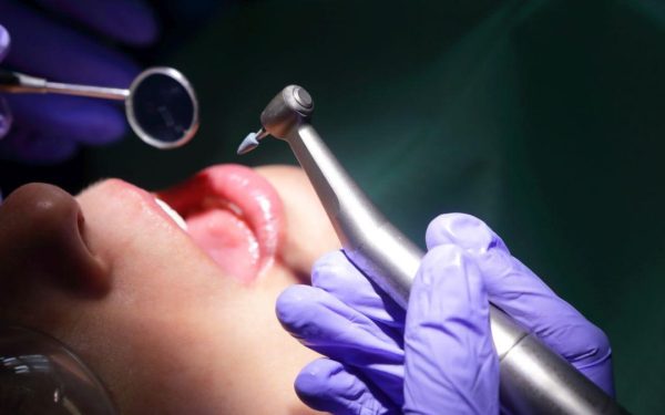 Stomatologul din Turcia, fatal pentru un pacient: Ce i s-a spus înainte de sinucidere