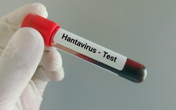 Hantavirus ucigător pe o navă: Ce riscuri sunt în România după decese
