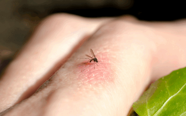 Curtea fără viespi și țânțari: Soluții naturale, recomandate de experți