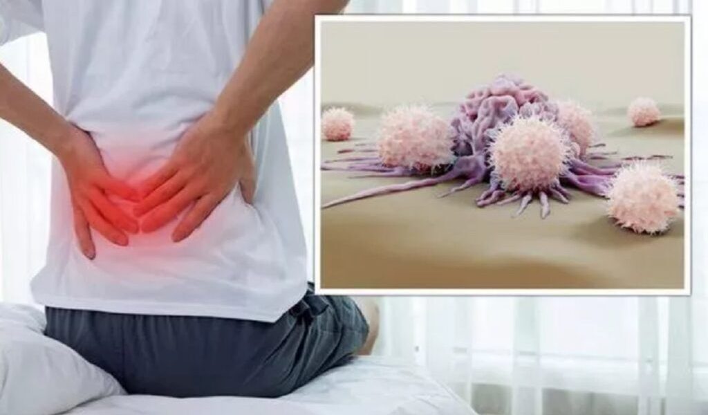 Cancer ascuns în dureri banale: 5 semne neașteptate la medic