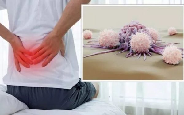 Cancer ascuns în dureri banale: 5 semne neașteptate la medic