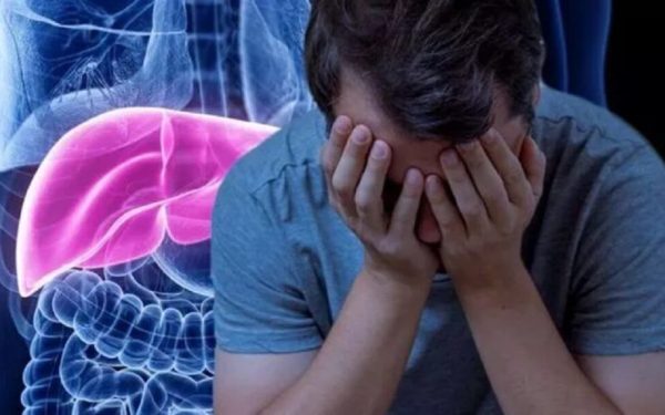 Doctor: Primele semne că ficatul a cedat din cauza alcoolului