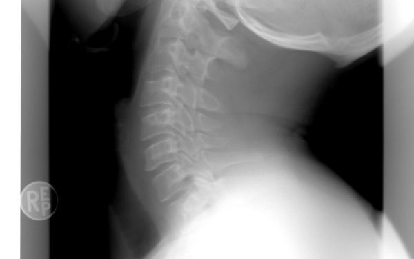 Spitalul Bihor: AI, un ajutor pentru radiologi în diagnosticarea urgențelor