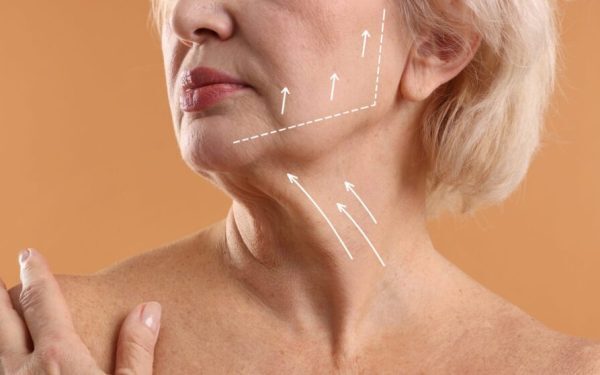 Gâtul are nevoie de bisturiu, nu de cosmetice: când e necesar liftingul cervical