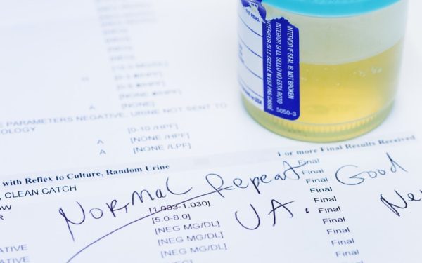 Test de urină: 9 din 10 cancere de vezică, depistate